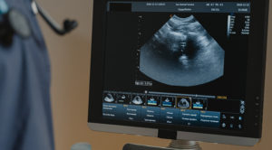 pet ultrasound on screen